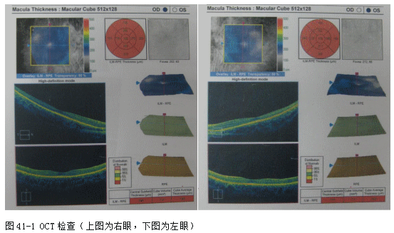 ZY016_224_1.gif